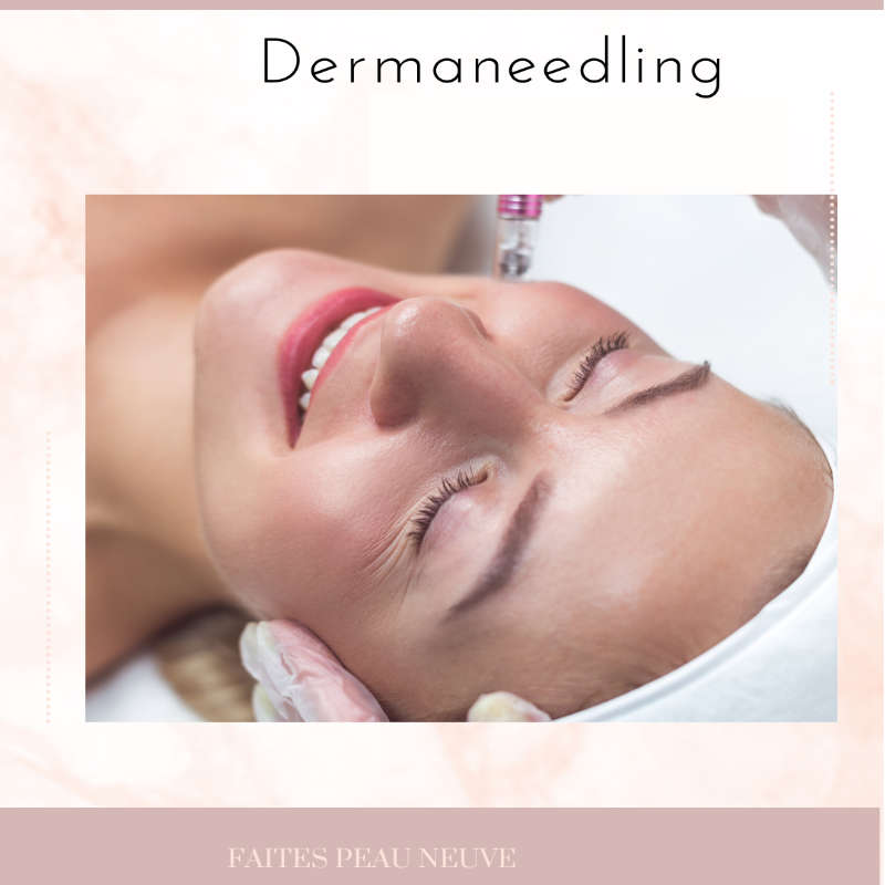 Dermaneedling Sabine Valenti Maquillage Permanent