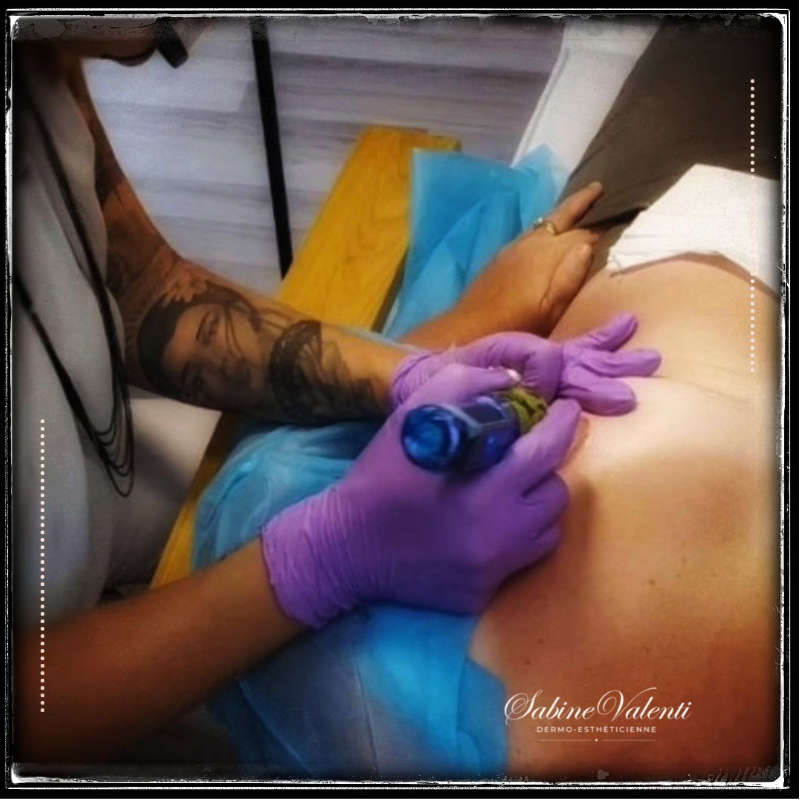 Technique tatouage aréoles mammaires Sabine Valenti Maquillage Permanent