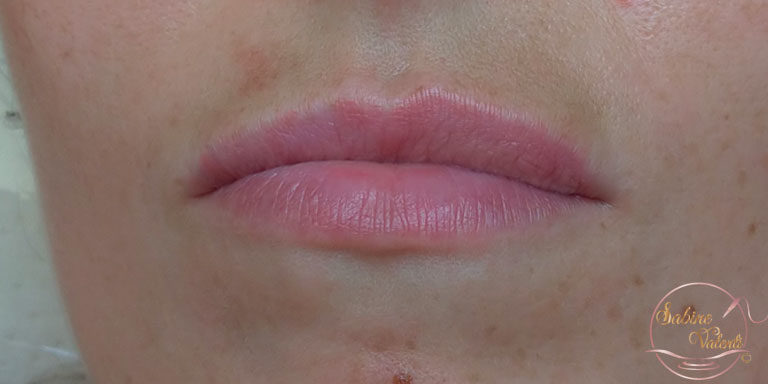 avant un maquillage permanent des lèvres Sabine Valenti